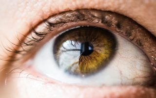 Ocular Hypertension: Understanding Elevated Eye Pressure